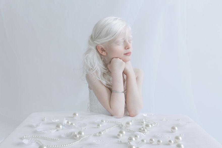 Гипнотическая красота людей-альбиносов