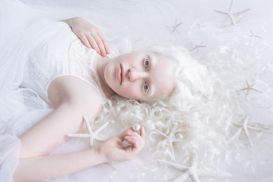 Гипнотическая красота людей-альбиносов