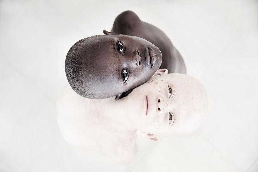 альбинос и темнокожий